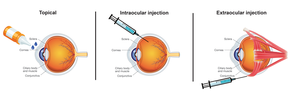 Model of the eye